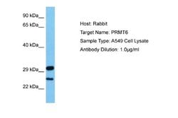 PRMT6 Antibody, Novus Biologicals 100 &mu;L; Unconjugated:Antibodies, Polyclonal
